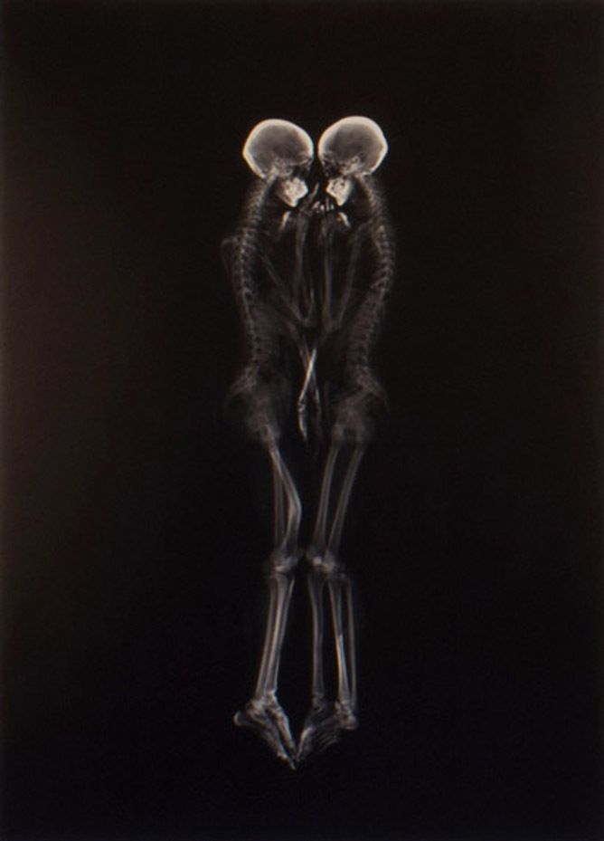 Un couple faisant l’amour au rayons X