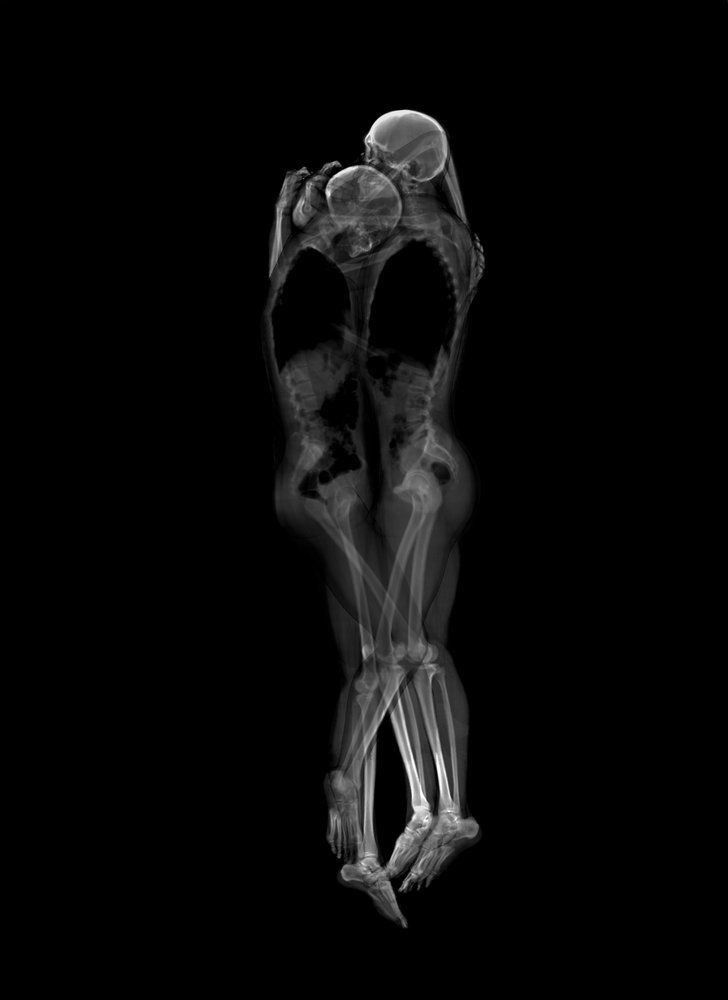Des couples faisant l’amour au rayons X