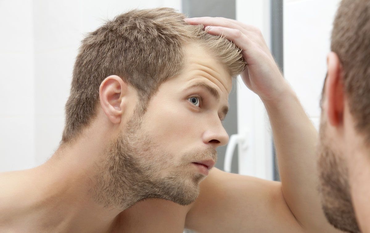 Handsome young man worried about hairloss